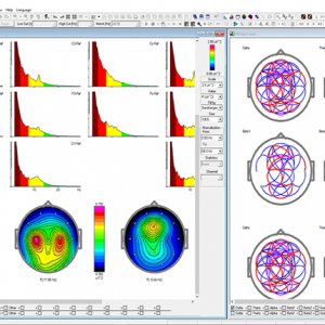 WinEEG advanced software - Image 6