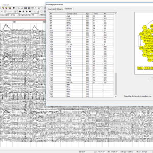 WinEEG advanced software - Image 7
