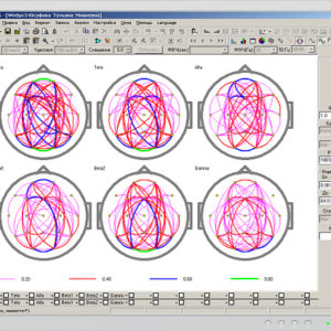 WinEEG advanced software - Image 4