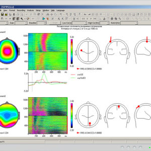 WinEEG advanced software - Image 5