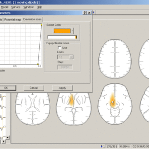 BrainLoc 3D Localization - Image 4