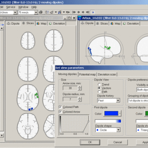 BrainLoc 3D Localization - Image 6
