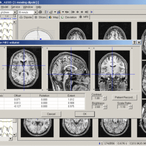 BrainLoc 3D Localization - Image 7