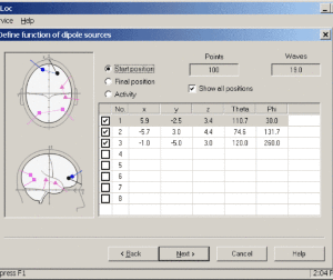BrainLoc 3D Localization - Image 8