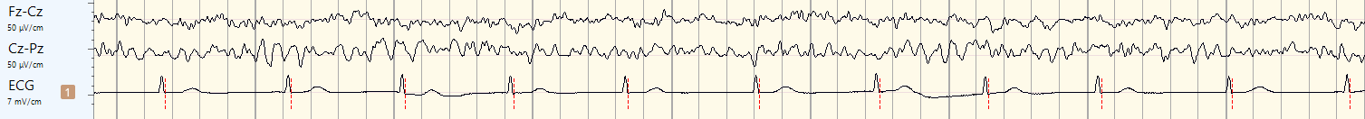 ECG/EOG/EMG biosignals recording Mitsar