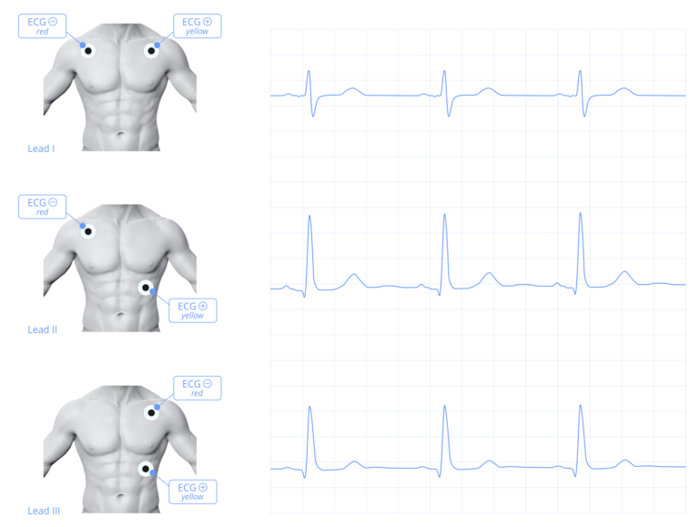 ECG/EOG/EMG biosignals recording Mitsar Neurodiagnostics